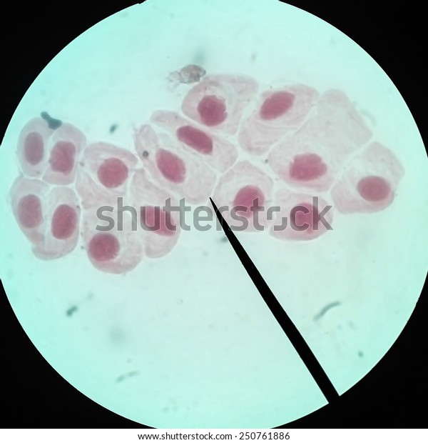 Living healthy cells (mitosis) - original\
micro-photo of tissue under a\
microscope