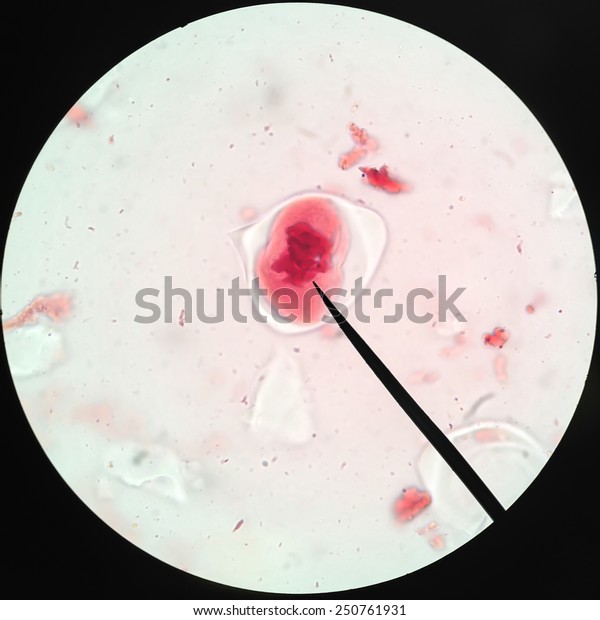 Living healthy cells (mitosis) - original
micro-photo of tissue under a
microscope