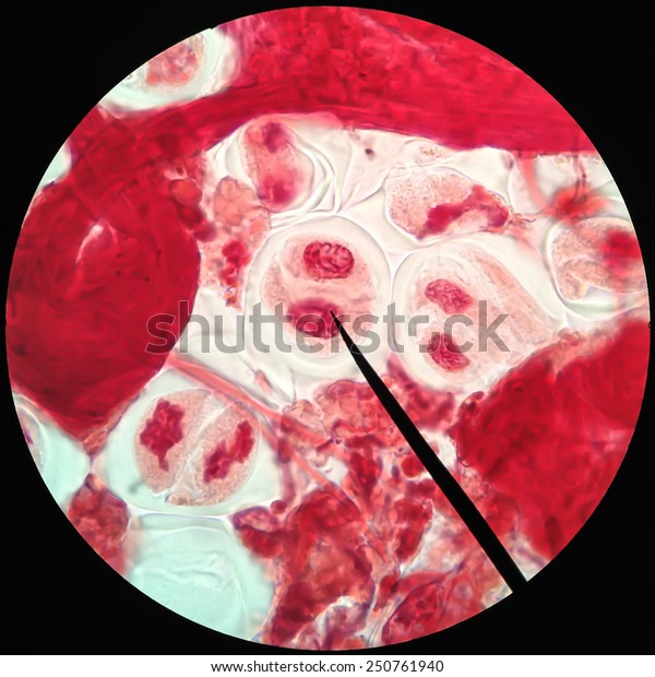 Living healthy cells (mitosis) - original\
micro-photo of tissue under a\
microscope