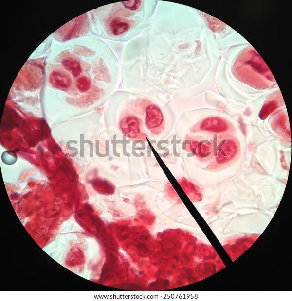 Living healthy cells (mitosis) - original\
micro-photo of tissue under a\
microscope