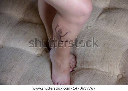 lizard is painted on the legs. Varicose veins on female legs. problems with female legs. Varicose veins