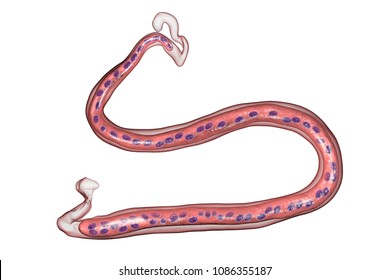 Loa loa, a roundworm nematode, the causative agents of Loa loa filariasis, 3D illustration showing presence of sheath around the worm and continous nuclei in the tail tip
