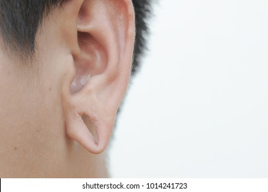 Lobe Hole,To Decorate The Ear, A Large Scar.