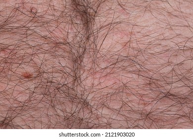 Long Hair On Human Skin, Skin With Hair Close