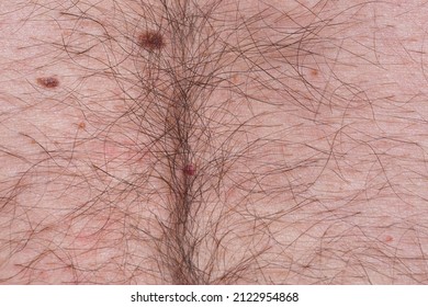 Long Hair On Human Skin, Skin With Hair Close