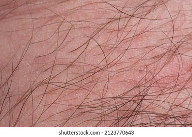 Long Hair On Human Skin, Skin With Hair Close