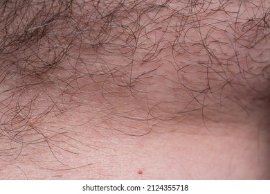 Long Hair On Human Skin, Skin With Hair Close