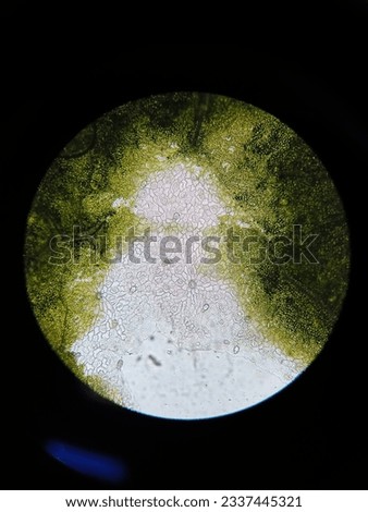 a longitudinal section of a leaf of a dicot plant.You can see some stomata cells and epidermal tissue and green chloroplast organelles.