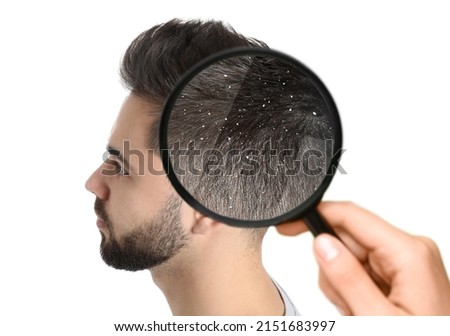Looking at young man's hair through magnifier on white background. Problem of dandruff Foto stock © 