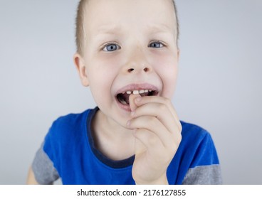 Loose Baby Teeth. Blond Boy Touches A Milk Tooth With His Hands And Shows How He Moves. Stages Of Growing Up.