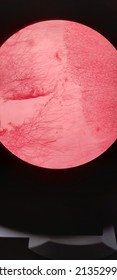 Loose Connective Tissue, Microscope Magnification Of 100 Times