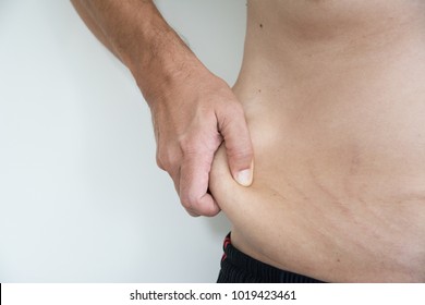 Loose Skin Problem In Men Due To Exercise