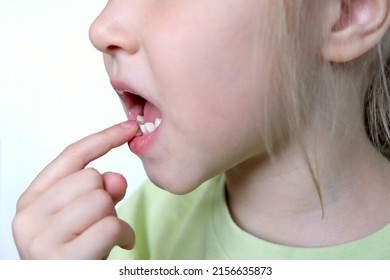 Loss of a baby's milk front tooth. Change of teeth.Children's health and dentistry. Focus on the tooth
changing teeth concept