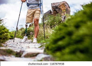 2,917 Prothesis Images, Stock Photos & Vectors | Shutterstock