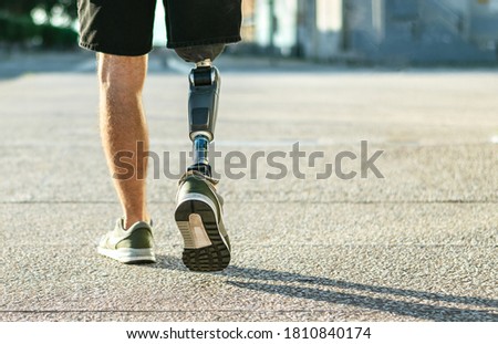 Low angle view at disabled young man with prosthetic leg walking along the street.