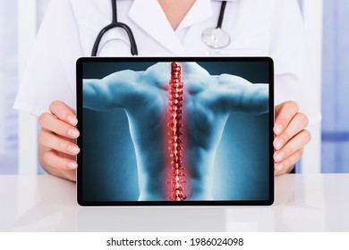 Low Back Pain And Joint Osteoporosis. Orthopedic Backache