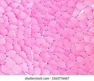 Low Magnification Light Microscope Micrograph Of Cross Sectioned Skeletal Muscle Fibers Showing The Presence Of Many Nuclei (multinucleated Cells) Located In The Cell Periphery.