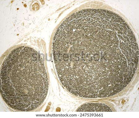Low magnification light microscope micrograph of cross-sectioned myelinated nerve fascicles stained with osmium tetroxyde to show the myelin sheath of nerve fibers. 