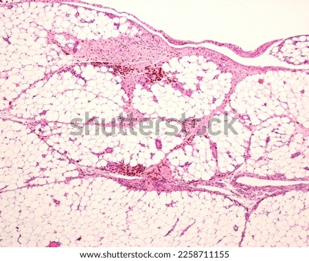 Low magnification micrograph of peritoneal fat showing macrophages marked with colloidal iron. Circulating colloidal iron is phagocyted by macrophages appearing as large brown cytoplasmic inclusions