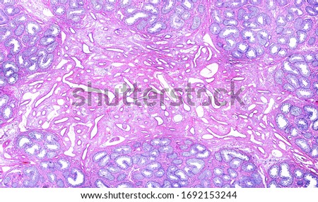Low magnification micrograph of the rete testis surrounded by several lobules of seminiferous tubules. The rete testis is a network of thin tubules lined by a simple cuboidal epithelium.