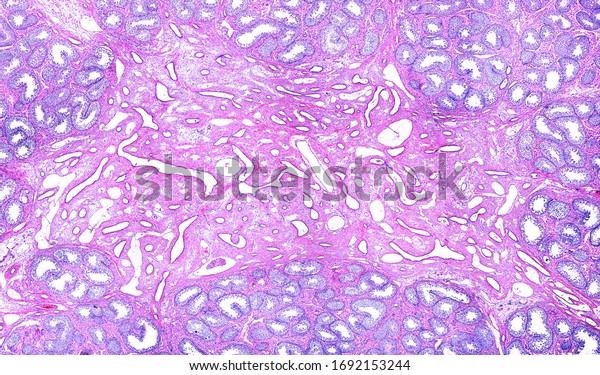 Low
magnification micrograph of the rete testis surrounded by several
lobules of seminiferous tubules. The rete testis is a network of
thin tubules lined by a simple cuboidal
epithelium.