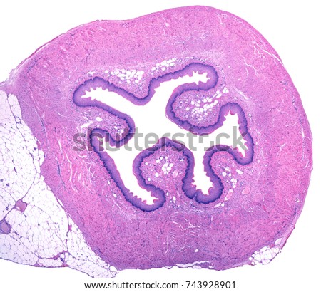 Low magnification micrograph showing a cross section of the esophagus. The mucosa lining the central lumen show folds covered by a stratified scamous epipthelium.