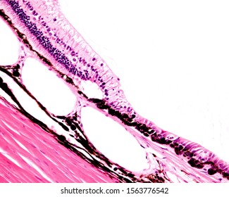 Low magnification micrograph showing the limit between retina and ciliary body (ora serrata).  Beneath, the pigmented vascularized choroid and the sclera can be seen.