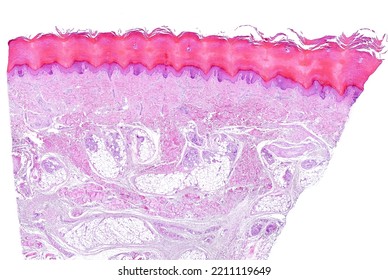 Low power light microscope micrograph of human glabrous skin. From top, the epidermis, showing a prominent horny layer, the dermis and hypodermis. Between dermis and hypodermis, eccrine sweat glands.  - Shutterstock ID 2211119649