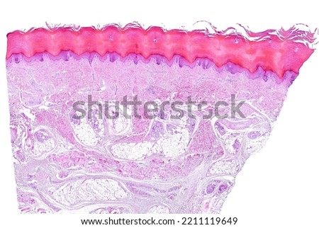 Low power light microscope micrograph of human glabrous skin. From top, the epidermis, showing a prominent horny layer, the dermis and hypodermis. Between dermis and hypodermis, eccrine sweat glands. 