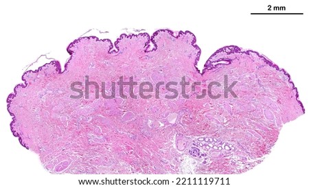 Low power light microscope micrograph of a human breast nipple covered by a pigmented thin skin and showing many fascicles of smooth muscle fibers (nipple erection). Scale bar=2 mm.