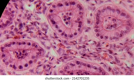 8,645 Epithelium Images, Stock Photos & Vectors | Shutterstock