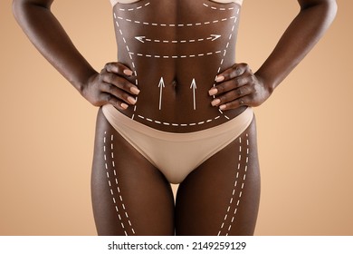 Lower Body Lifts Concept. Cropped Of African American Woman In Underwear With White Pen Marks Over Her Body Hips And Belly Posing On Beige Background Before Plastic Surgery, Collage