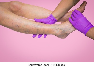 Lower limb vascular examination because suspect of venous insufficiency. The female legs on pink background