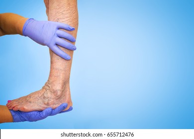 Lower limb vascular examination because suspect of venous insufficiency