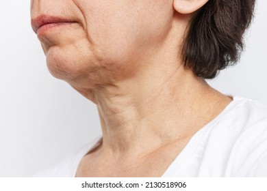 The Lower Part Of Elderly Woman's Face And Neck With Signs Of Skin Aging Isolated On A White Background. Age-related Changes, Flabby Sagging Facial Skin. Cosmetology And Beauty Concept