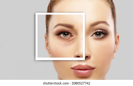 Lower and upper Blepharoplasty.Marking the face.Perforation lines on females face, plastic surgery concept.