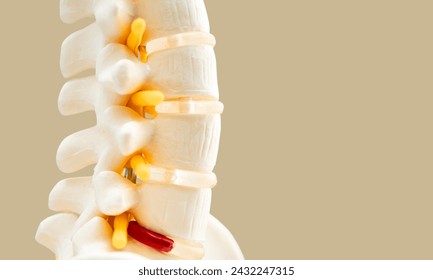 L-S spine X-ray image, AP view, comparison between normal and ankylosing spondylitis lumbar

