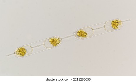 Lugol Preserved Sample Of Marine Phytoplankton Ditylum Sp. 400x Magnification With Selective Focus