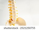 Lumbar spine displaced herniated disc fragment, spinal nerve and bone. Model for treatment medical in the orthopedic department.