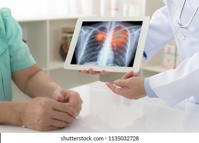 Lung Cancer Concept. Doctor Explaining Results Of Lung Check Up From X-ray Scan Chest On Digital Tablet Screen To Patient.