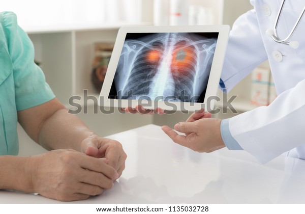 lung cancer concept. doctor explaining results\
of lung check up from x-ray scan chest on digital tablet screen to\
patient.