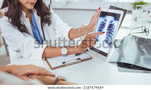 Lung cancer concept. Doctor explaining results of\
lung check up from x-ray scan chest on digital tablet screen to\
patient. The doctor is analyzing and clarifying images of the\
patient\'s lung X-rays.