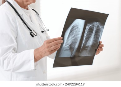 Lung disease. Doctor examining chest x-ray in clinic, closeup - Powered by Shutterstock