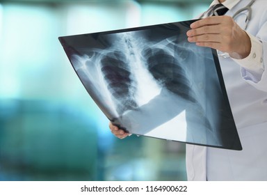 Lung Radiography Concept. Radiology Doctor Examining At Chest X Ray Film Of Patient At Hospital Room.