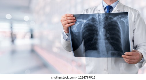 lung radiography concept. radiology doctor examining at chest x ray film of patient at hospital room.