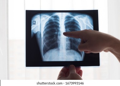 Radiographie Images Stock Photos Vectors Shutterstock