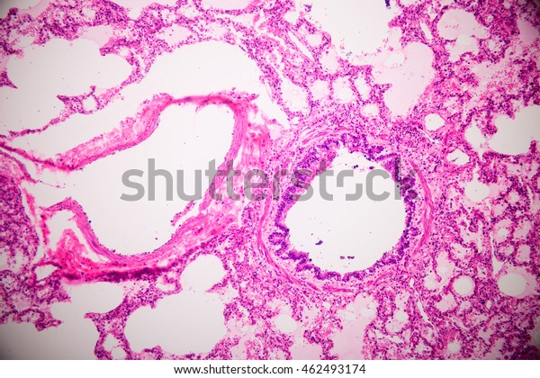 5 Epithelial Cells In Pleura Images, Stock Photos & Vectors | Shutterstock