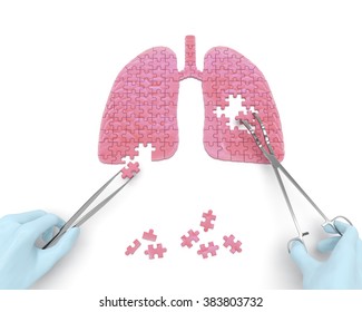 Lungs operation puzzle concept: hands of surgeon with surgical instruments (tools) perform lungs surgery as a result of respiratory disease, pneumonia, tuberculosis, bronchitis, asthma, lung abscess