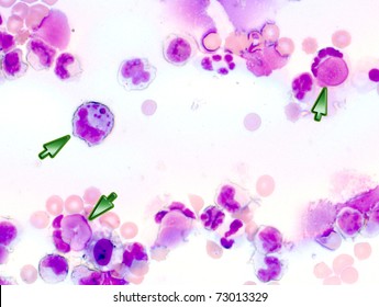 Lupus Erythematosus Cell