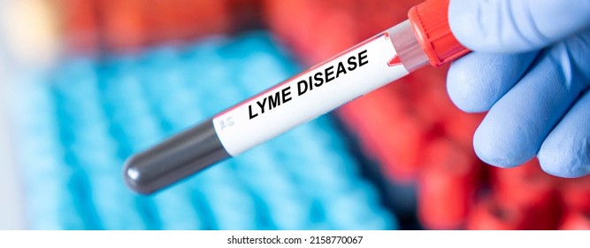 Lyme Disease Lyme Disease Disease Blood Stock Photo 2158770067 ...